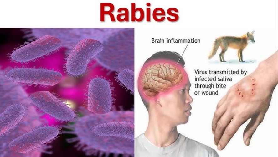 Rabies Virus - Most Dangerous Viruses in Human History